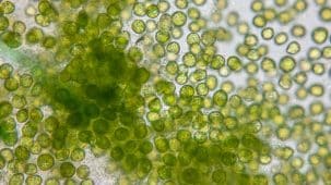 Chorelle vue dans un microscope. On aperçoit des micro algues vert clair