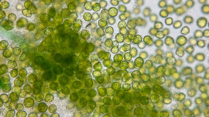 Chorelle vue dans un microscope. On aperçoit des micro algues vert clair
