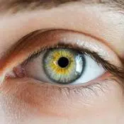 Vitamine A et vision : Œil vu de près. L'iris est bleu clair sur les cotés et jaune à l'intérieur.